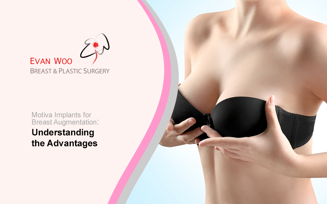 Motiva Implants for Breast Augmentation: Understanding the Advantages